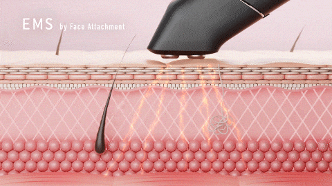 イーポレーション・シュプリームの高周波域EMS(EMS)使用時の様子